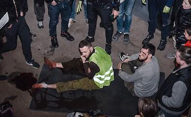 russische Botschaft in London beschuldigt Ukraine, Fotos von verwundeten Zivilisten gef&auml;lscht zu haben