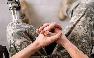 Welche Unterst&uuml;tzung wird vom Staat f&uuml;r Prothesen gew&auml;hrt?