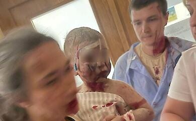 Ein Teil des gr&ouml;&szlig;ten Kinderkrankenhauses der Ukraine ist durch russischen Beschuss eingest&uuml;rzt