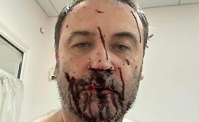 Details des versuchten Attentats auf den russischen Oppositionsaktivisten Ilja Ponomarjow sind bekannt geworden