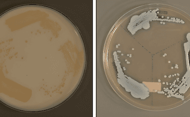 Wissenschaftler in Singapur haben eine neue Art eines tödlichen Pilzes entdeckt