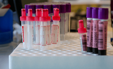 Indien verzeichnet ersten Fall einer Infektion mit neuem Affenpockenstamm