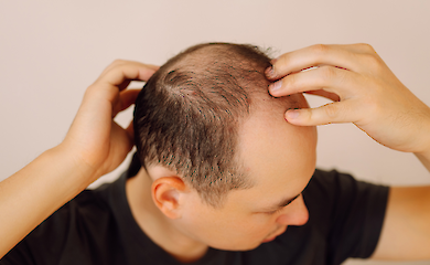Wie regelm&auml;&szlig;iges Stevia das Haarwachstum f&ouml;rdert