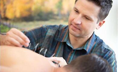 Akupunktur reduziert die Häufigkeit von Migräneanfällen