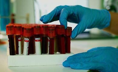 Langlebigkeitstest: Im Blut gefundene Marker, die das Sterberisiko "erraten"