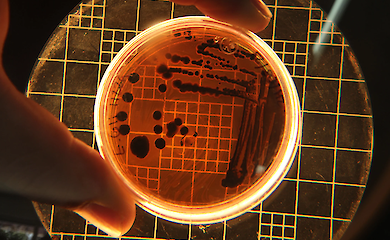 Mikroorganismen, die unter extremen Bedingungen unter dem Mikroskop &uuml;berleben k&ouml;nnen
